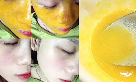 Đánh bay tàn nhang, nám da sau sinh cực đơn giản bằng nghệ tươi